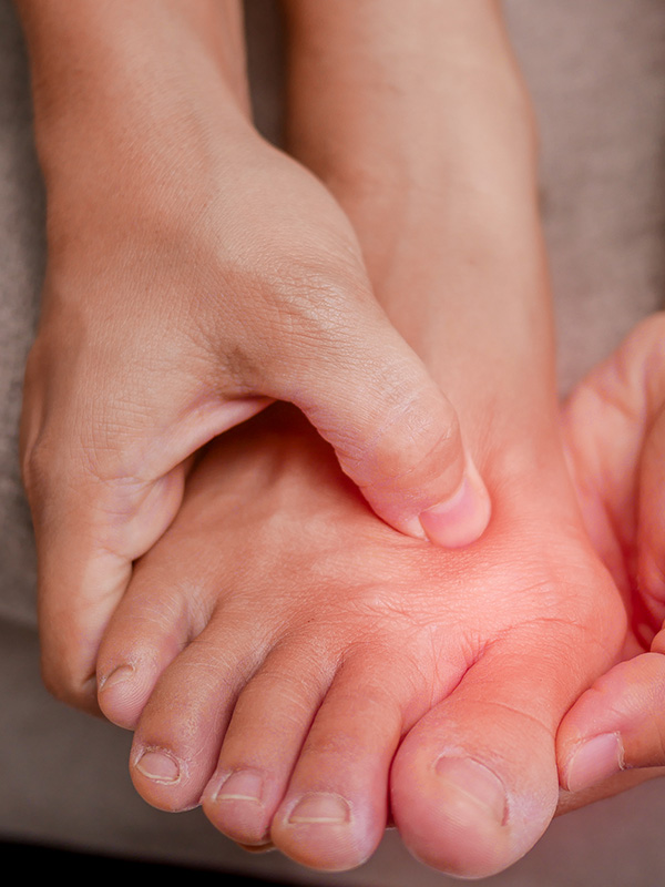Female holding her painful feet and massaging her bunion toes to relieve pain